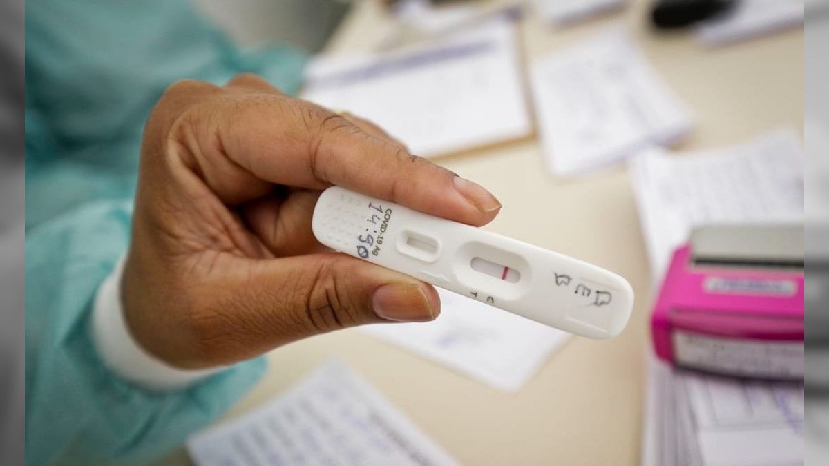 RJ: cenário epidemiológico de covid-19 tem tendência de redução