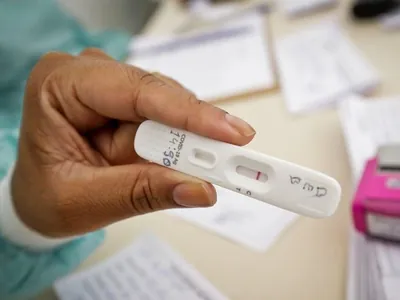 RJ: cenário epidemiológico de covid-19 tem tendência de redução