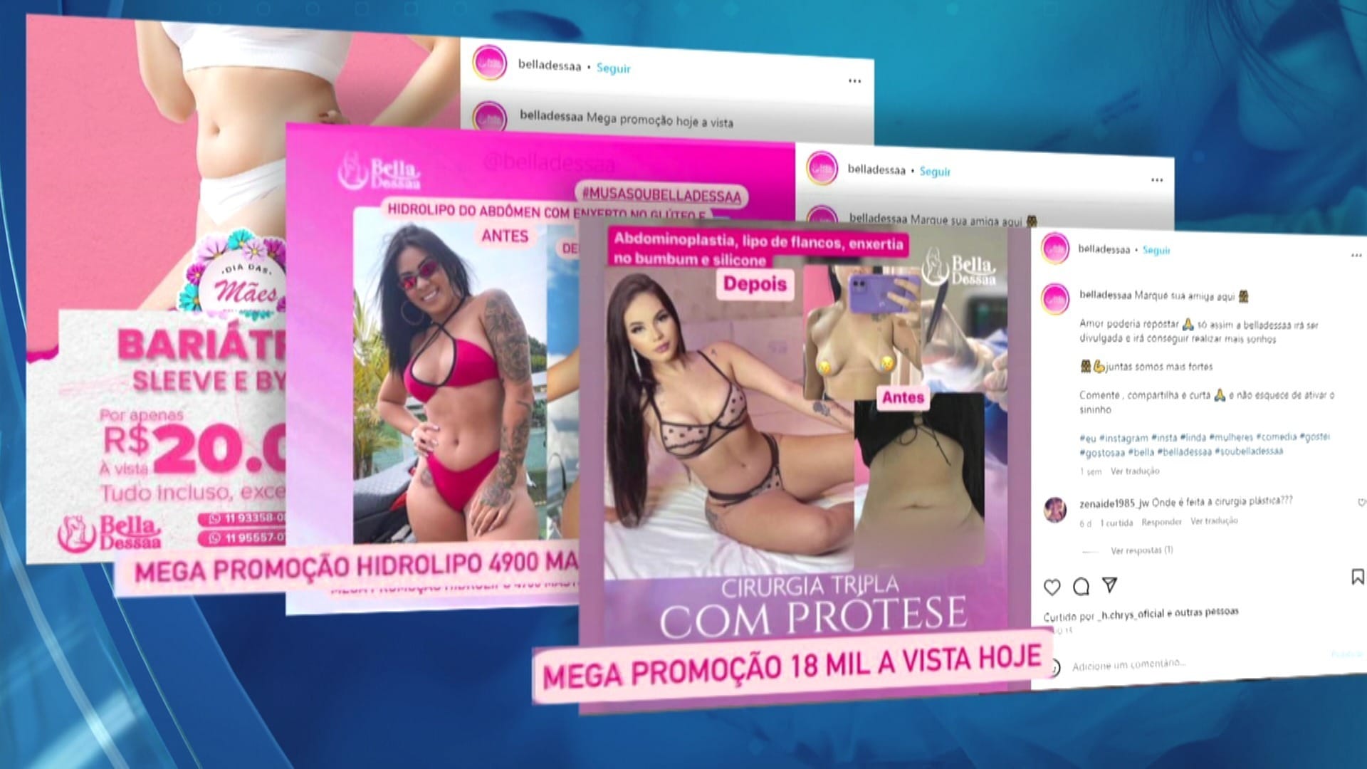 Exclusivo: Intermediários vendem nas redes sociais plástica sem avaliação médica