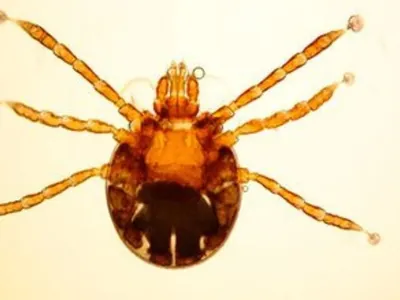 Febre maculosa: o que é a doença que matou piloto e esposa