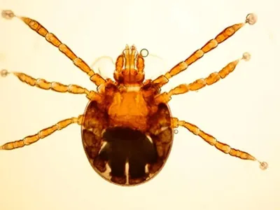 Campinas confirma terceira morte por febre maculosa