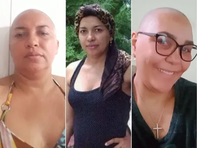 Quando o SUS leva cura a mulheres condenadas pelo diagnóstico do câncer de mama