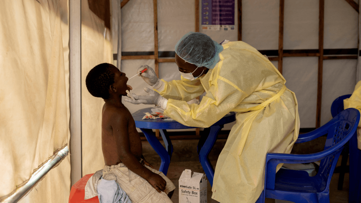 Mpox: entenda como o vírus é transmitido e os principais sintomas
