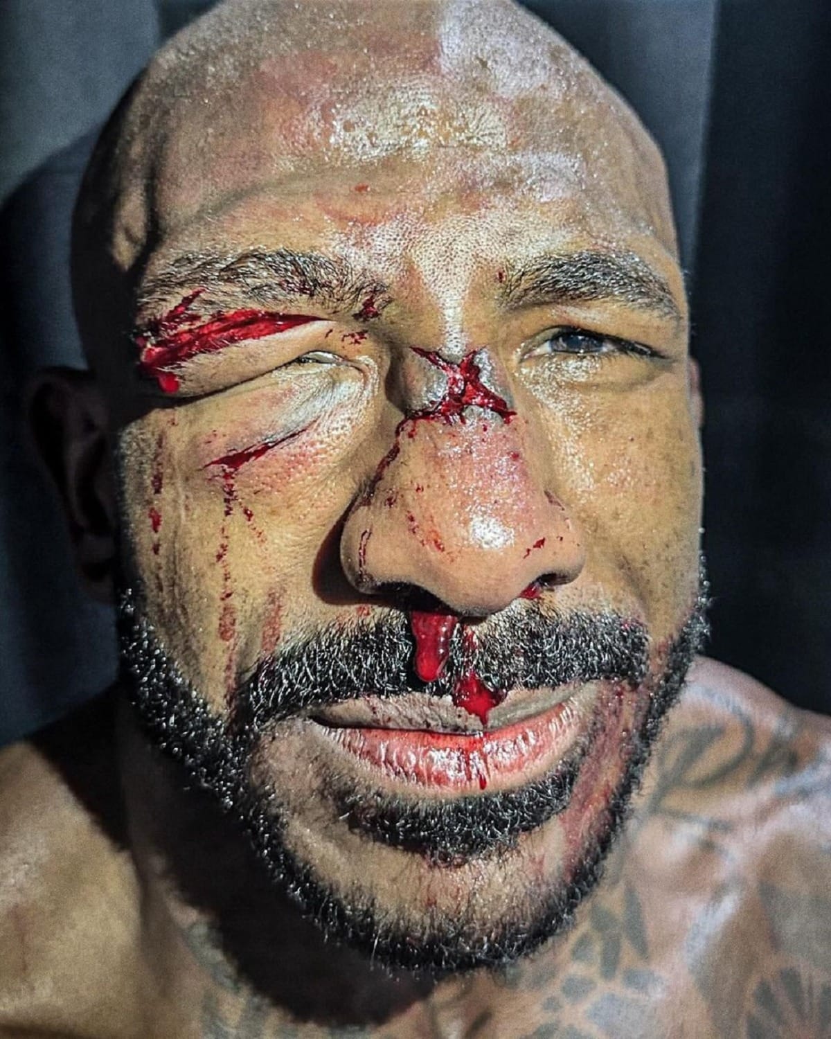 Rountree Jr. fica irreconhecível e com rosto desfigurado após nocaute de Poatan no UFC; veja