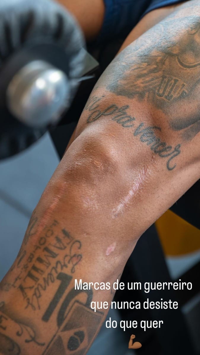 Neymar mostra cicatrizes no joelho (Imagem: @neymarjr/Instagram)