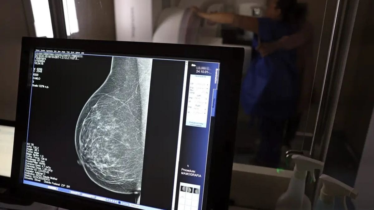 Anvisa aprova novo remédio oral para câncer de mama avançado