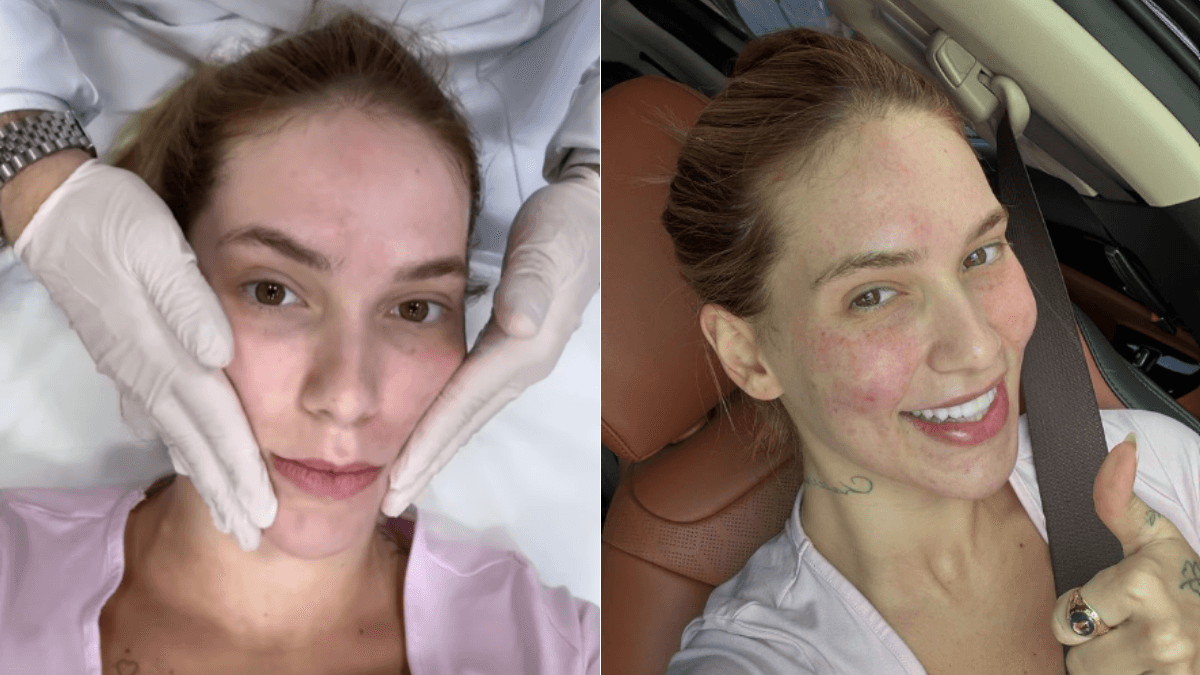 Virginia Fonseca usa esperma de salmão no rosto: "Me mimei"