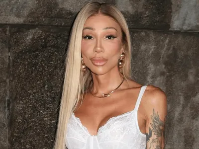 Mayara Massafera faz cirurgia inédita no Brasil para diminuir ombros