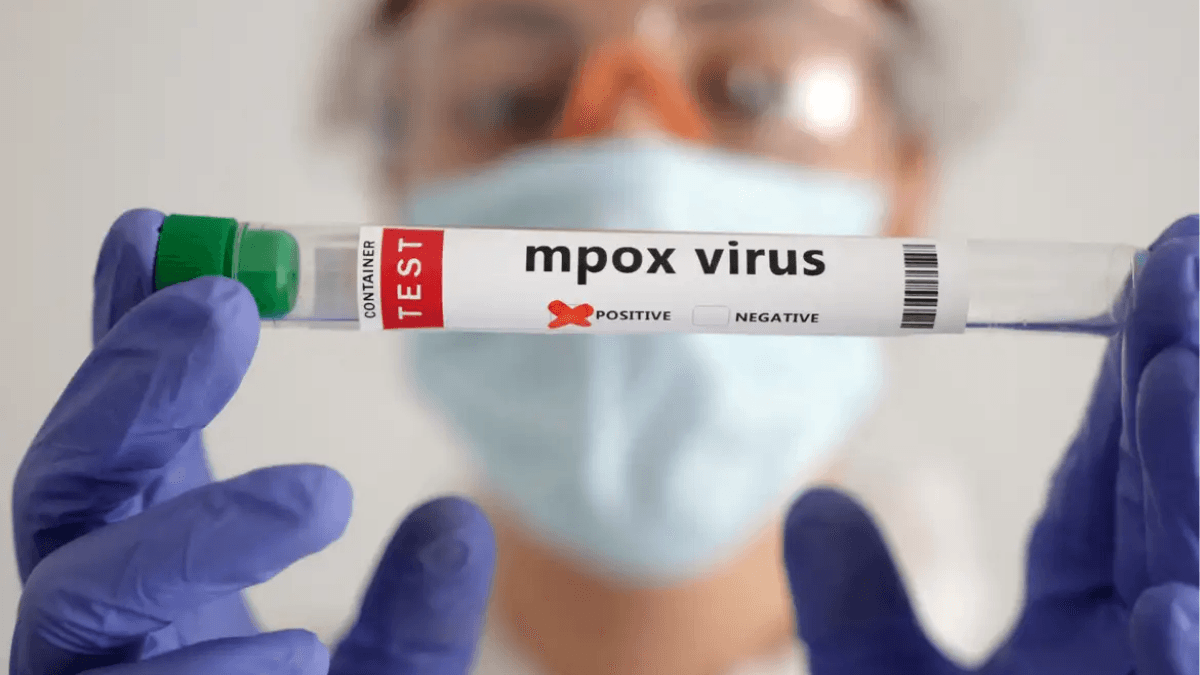 São Paulo confirma primeiro caso da nova cepa de Mpox