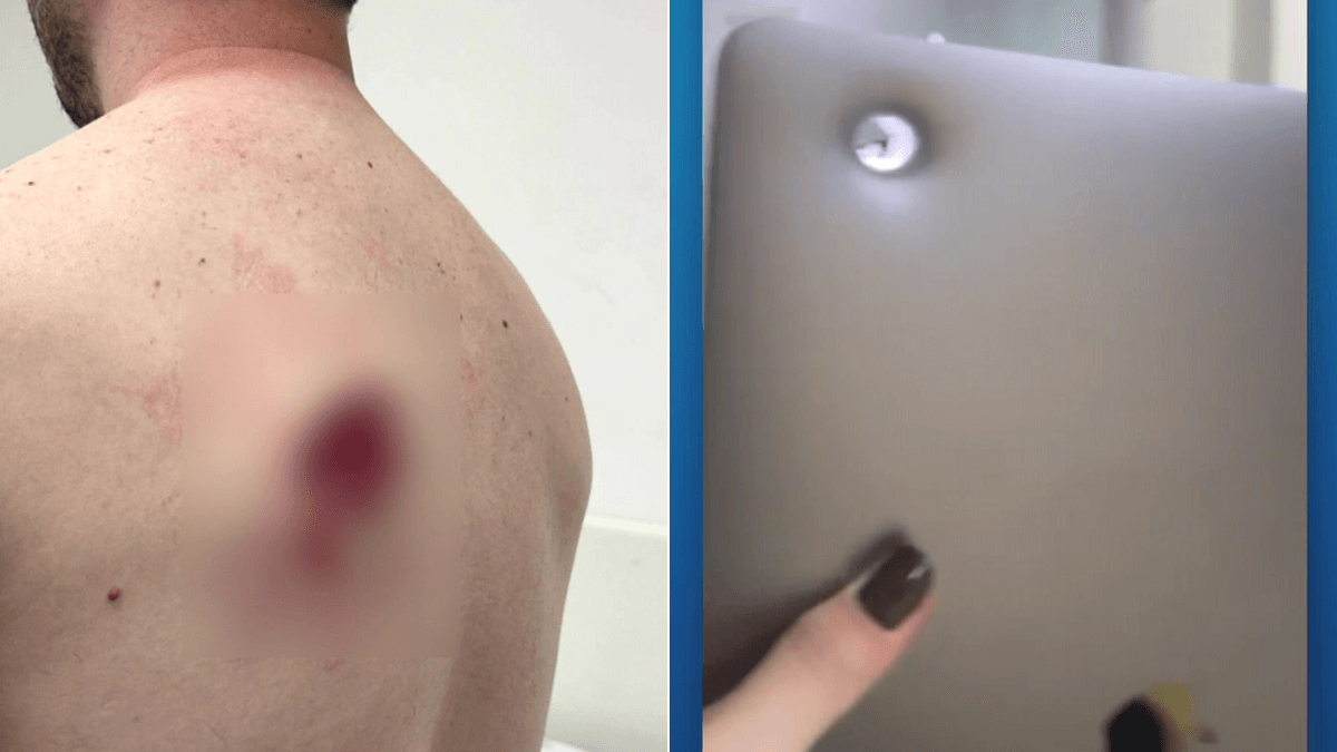 Motociclista é ‘salvo’ por notebook ao ser baleado em assalto na Zona Oeste de SP