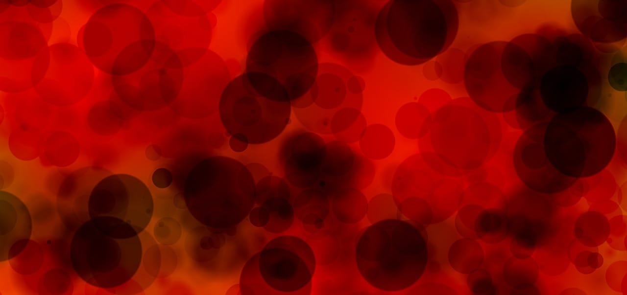 Linfoma: o que é, como identificar os sintomas e quais são os tratamentos