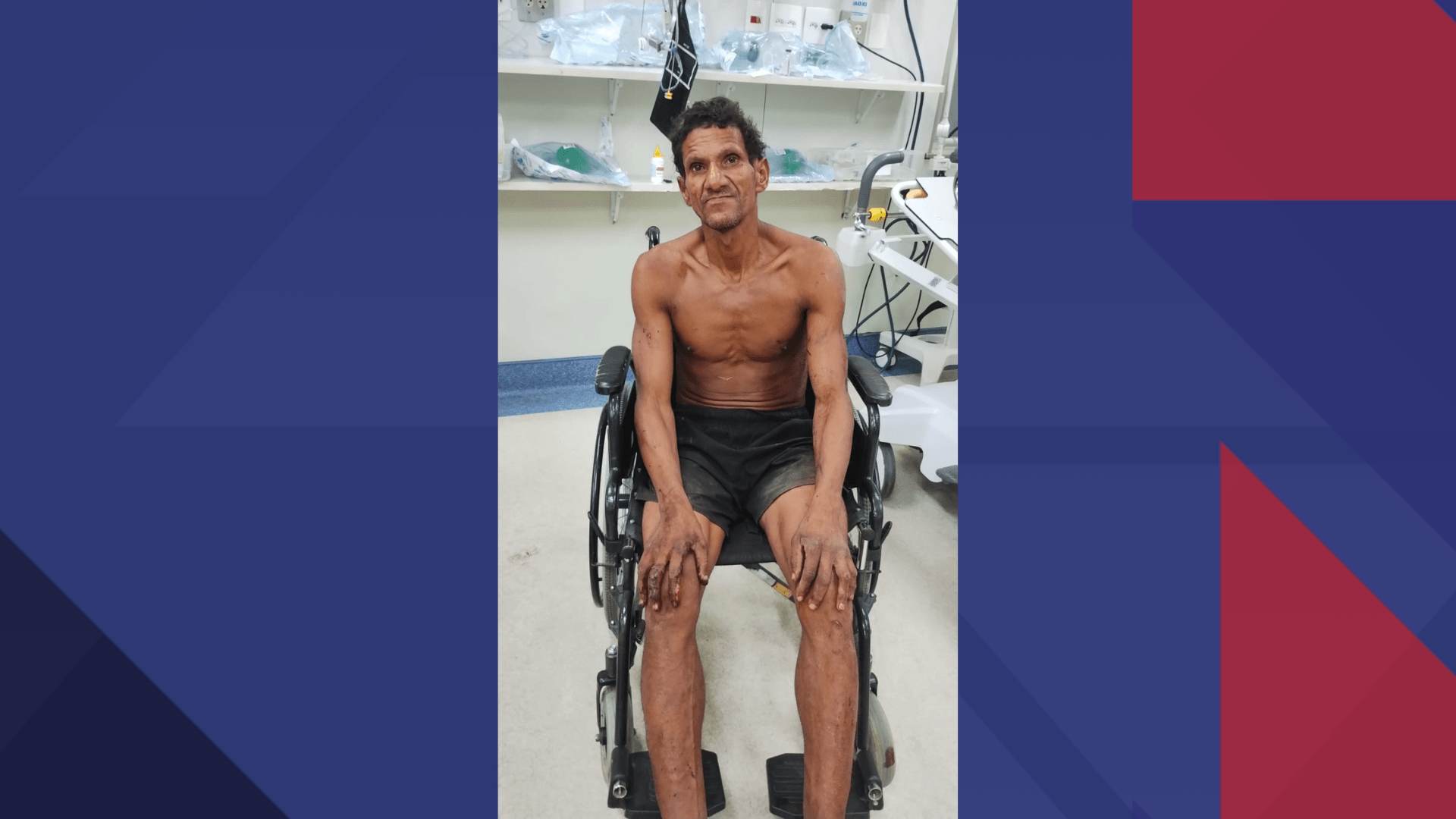 Homem flagrado invadindo apartamento em Ipanema está internado