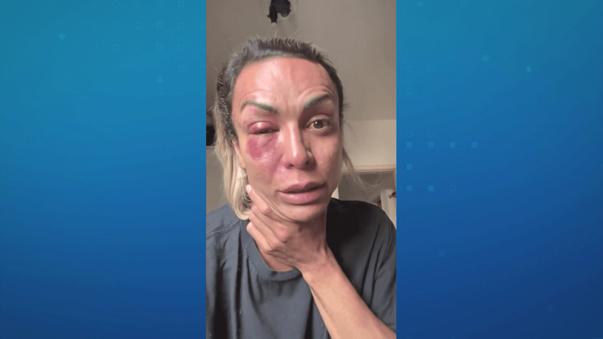 Ativista trans é agredida dentro de prédio em SP: "Se não viesse ninguém ele teria me matado"