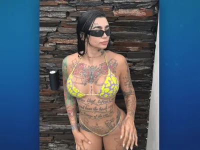 Cantora brasileira morre após fazer lipoaspiração em clínica na Turquia