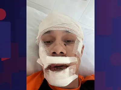 Polícia tenta identificar agressor de personal carioca atacado com taça em bar de São Paulo