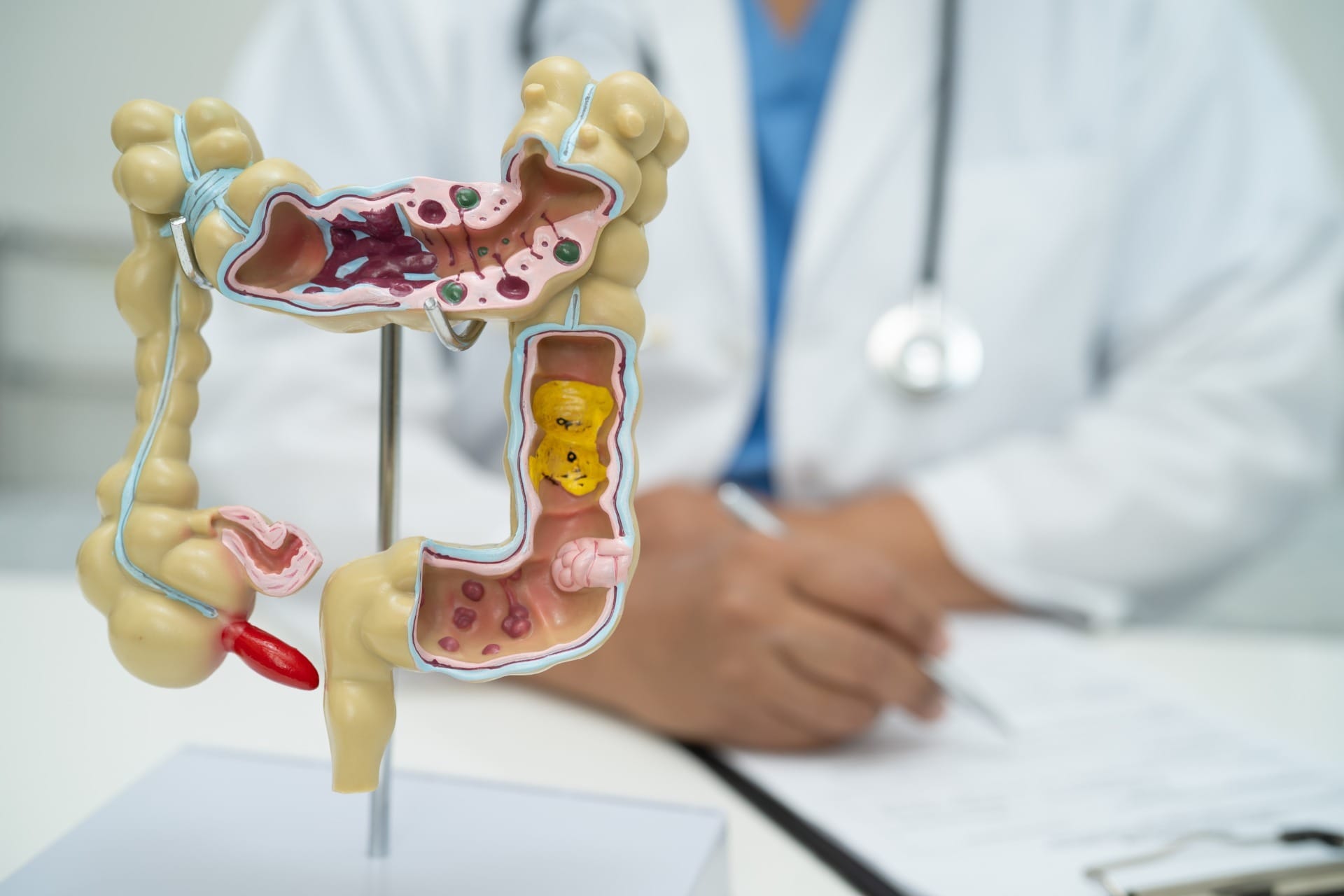 Intestino grosso, formado por cólon e reto, é onde se desenvolve o câncer colorretal | Crédto: Envato