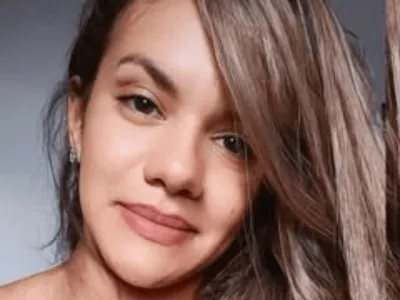Cirurgia de reconstrução da mulher que levou 61 socos do namorado é considerada um sucesso