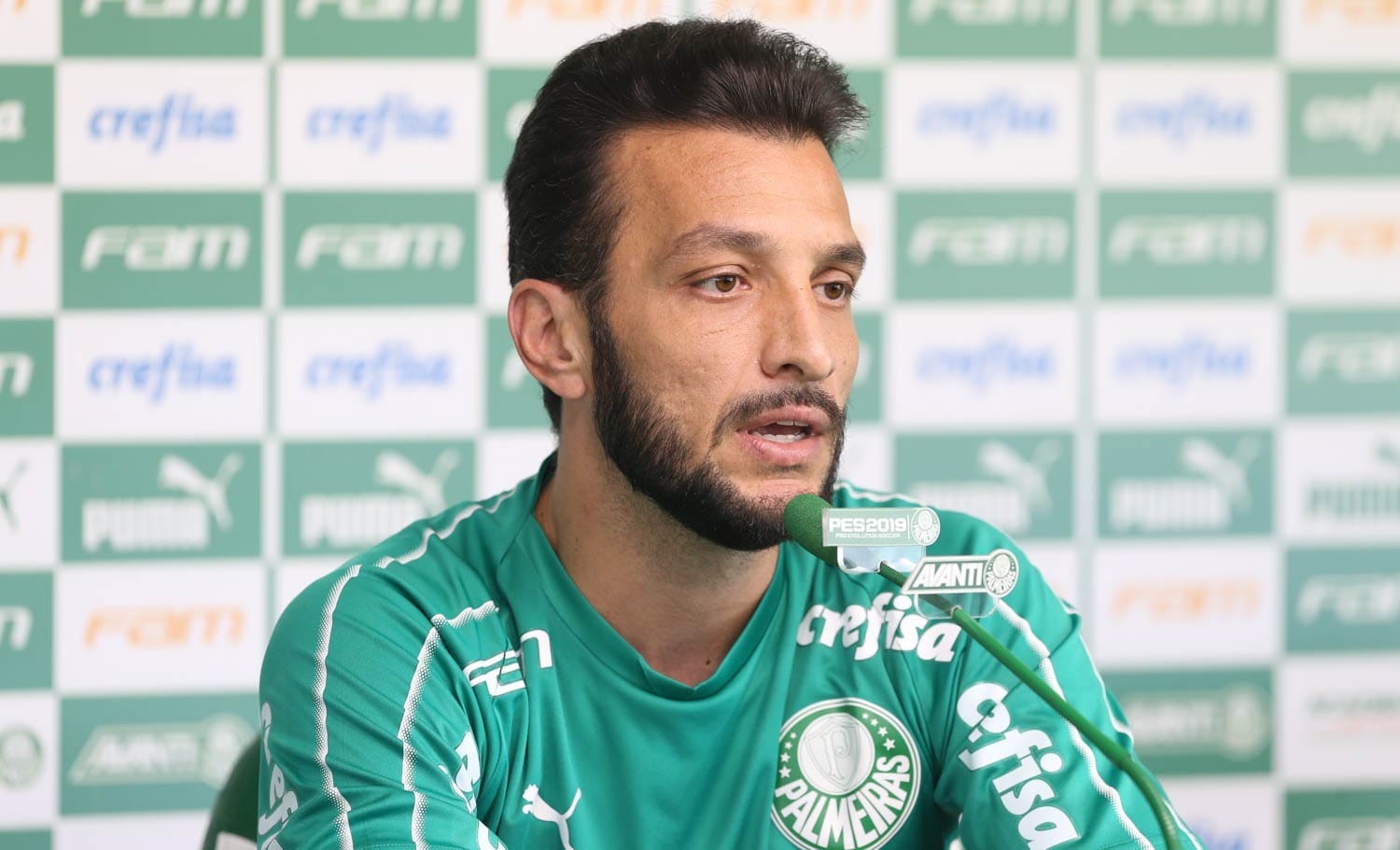 Calvície no campo? Veja os jogadores que aderiram ao transplante capilar