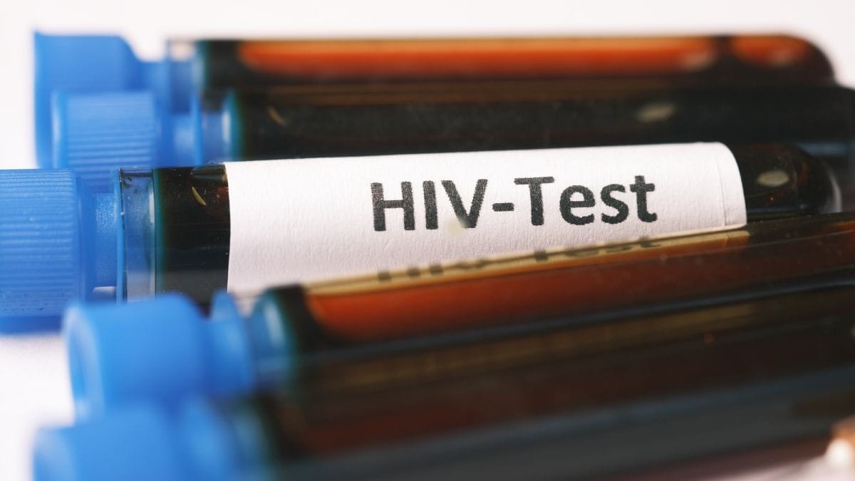 Injeção para prevenir infecção pelo vírus do HIV é aprovada pela Agência Europeia