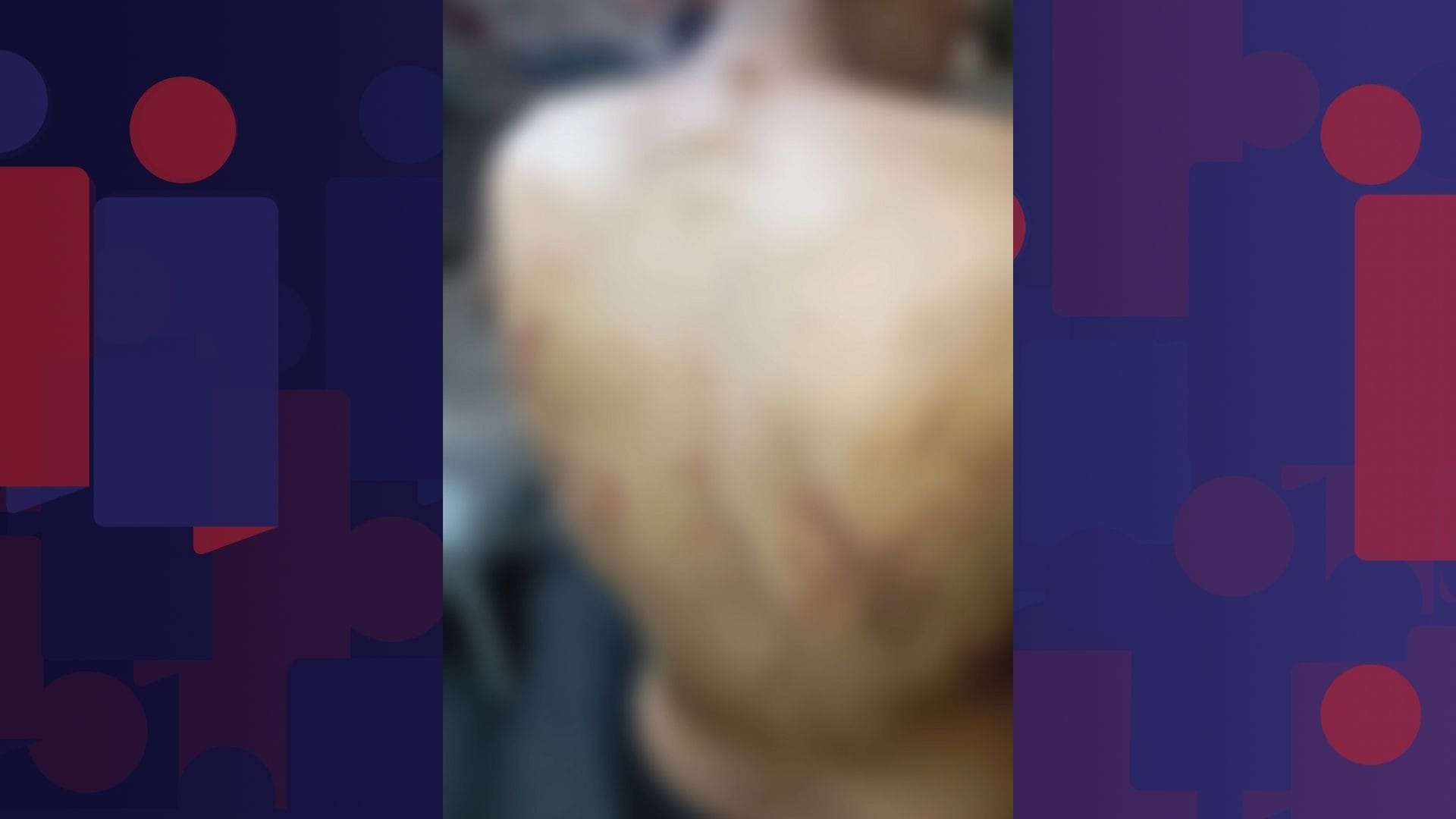 Polícia procura mulheres acusadas de torturar entregador de aplicativo no Rio