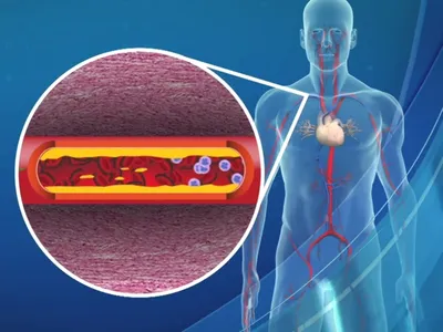 4 mitos sobre colesterol que podem colocar a saúde cardiovascular em risco