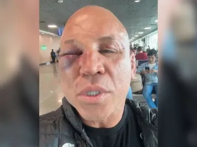 Wanderlei Silva quebra o silêncio sobre confusão com Popó: "Fui covardemente agredido"