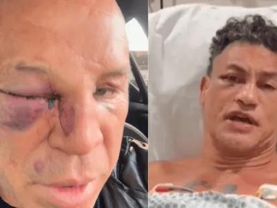 Falta de memória e mão quebrada: como ficaram Wanderlei e Popó após a briga