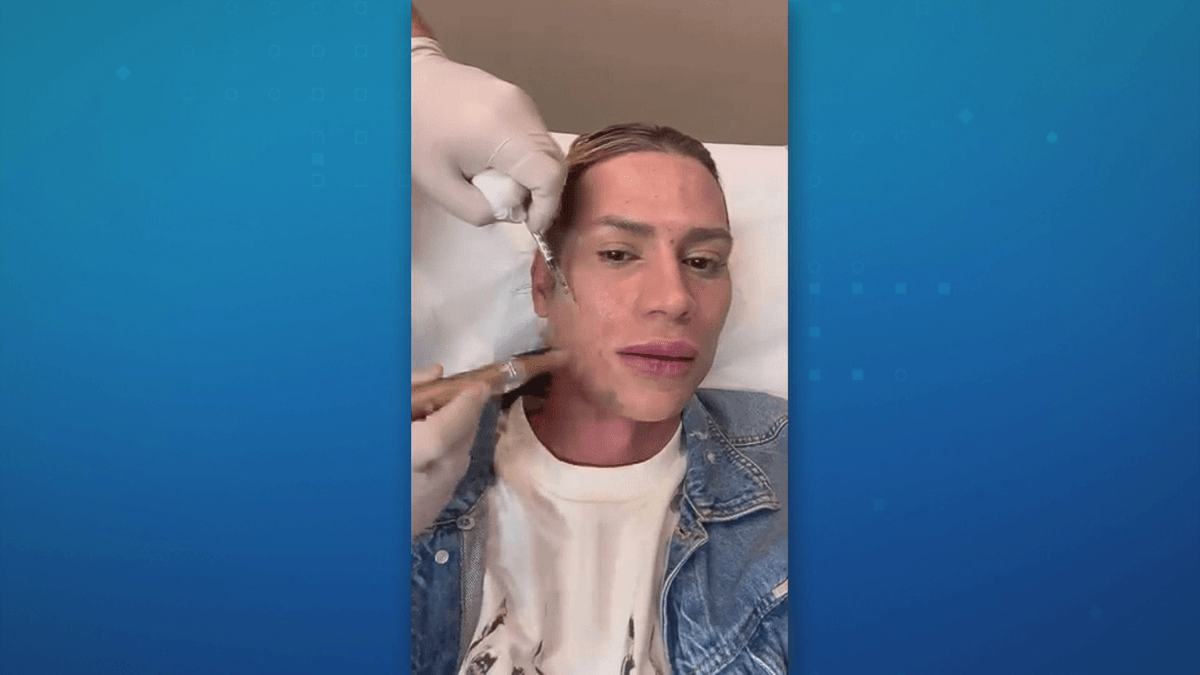 Influencer morre após complicações de procedimento estético no rosto em SP