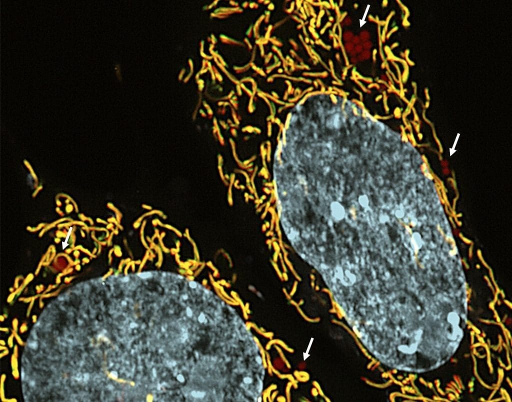 Pesquisa revela possibilidade de nova terapia com medicamentos contra doenças hereditárias