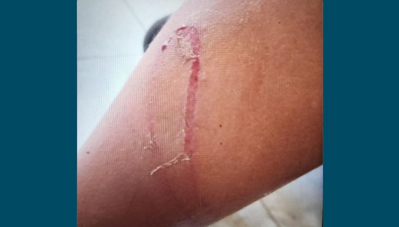 Suspeito de espancar menino de 9 anos é preso em Cerquilho 1