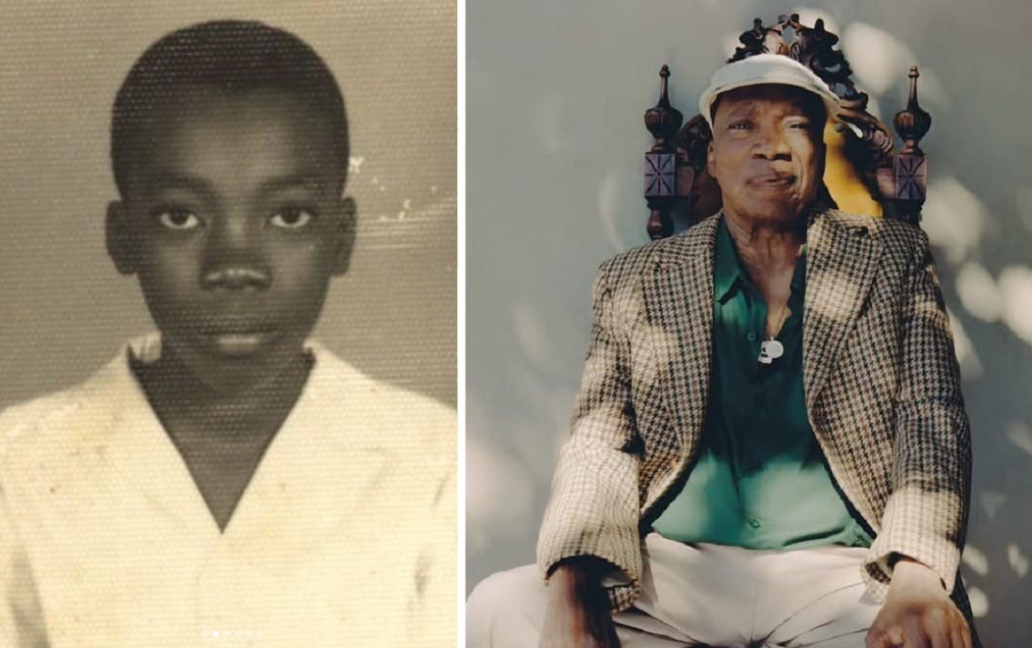 Milton Nascimento celebra 83 anos com doença que acomete 57 milhões no mundo