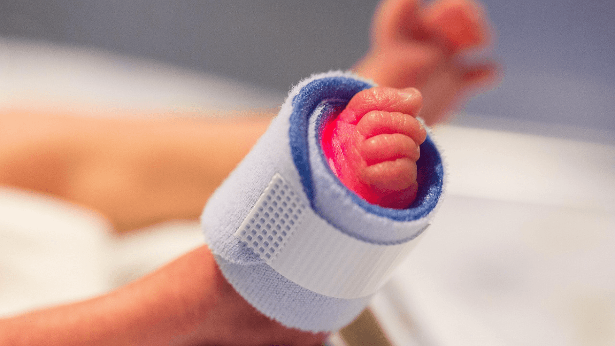 O que é o Novembro Roxo? Entenda a campanha que alerta para os riscos da prematuridade