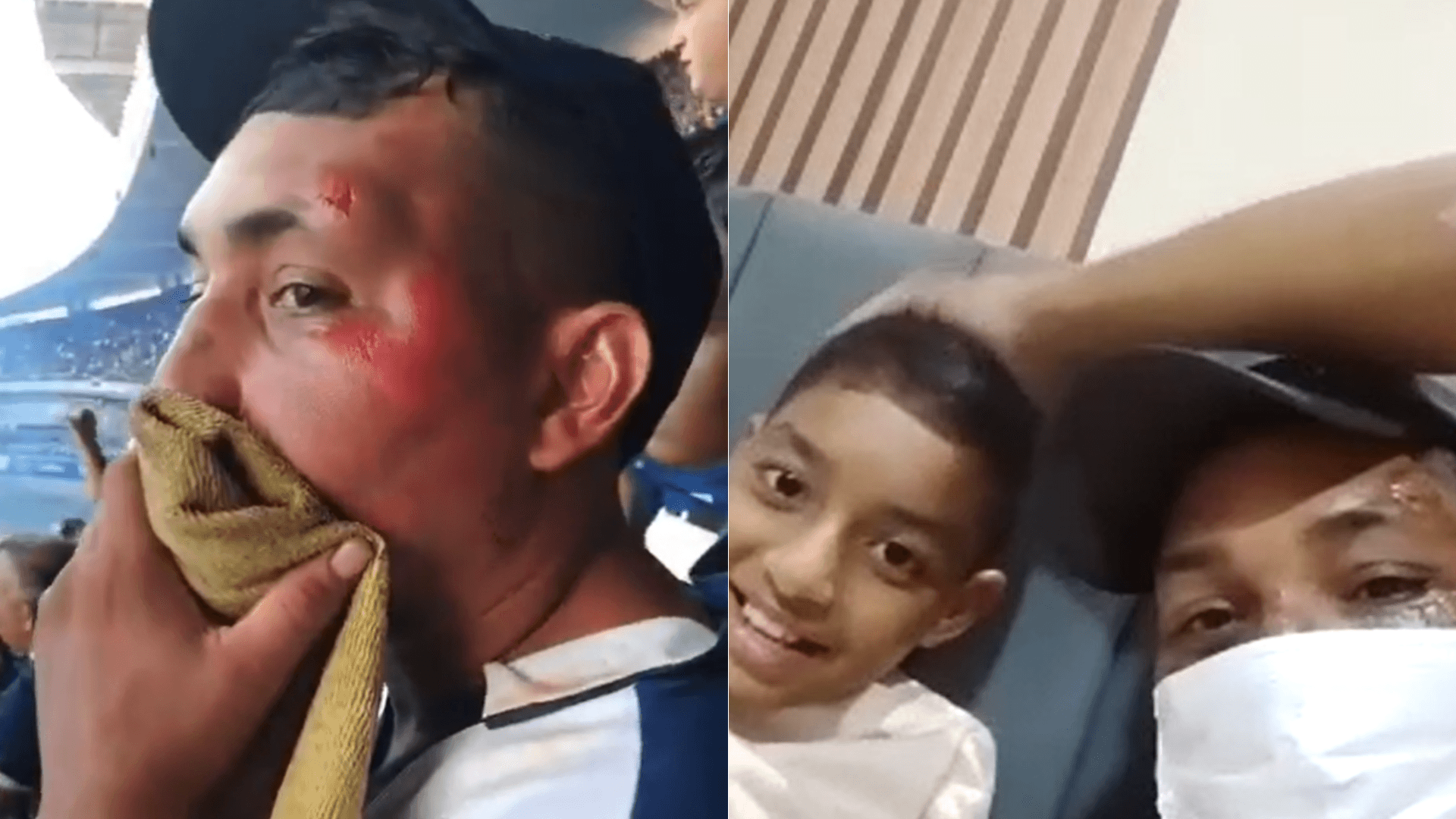 Torcedor do Remo é atropelado, mas vai ao jogo por causa do filho