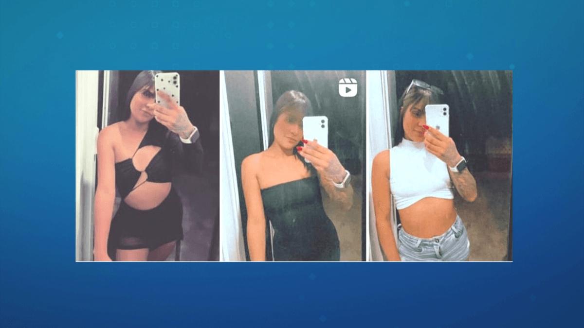 Mulher tem pernas amputadas após ser atropelada e arrastada por 1 km em SP