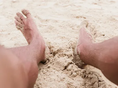 Como evitar bicho-geográfico e outras infecções de pele na areia