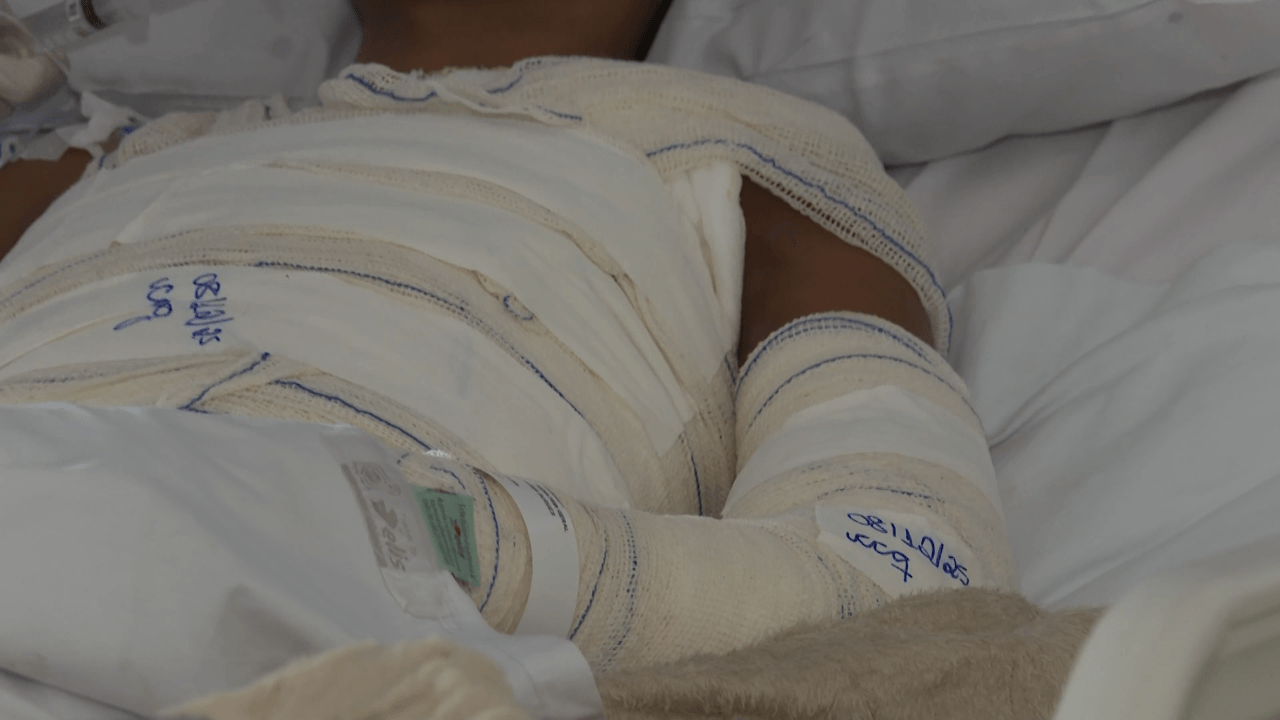 Férias elevam alerta para acidentes domésticos com crianças