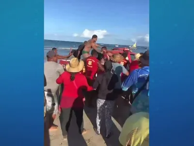 Turista agredido em praia de PE passa por cirurgia para corrigir fraturas