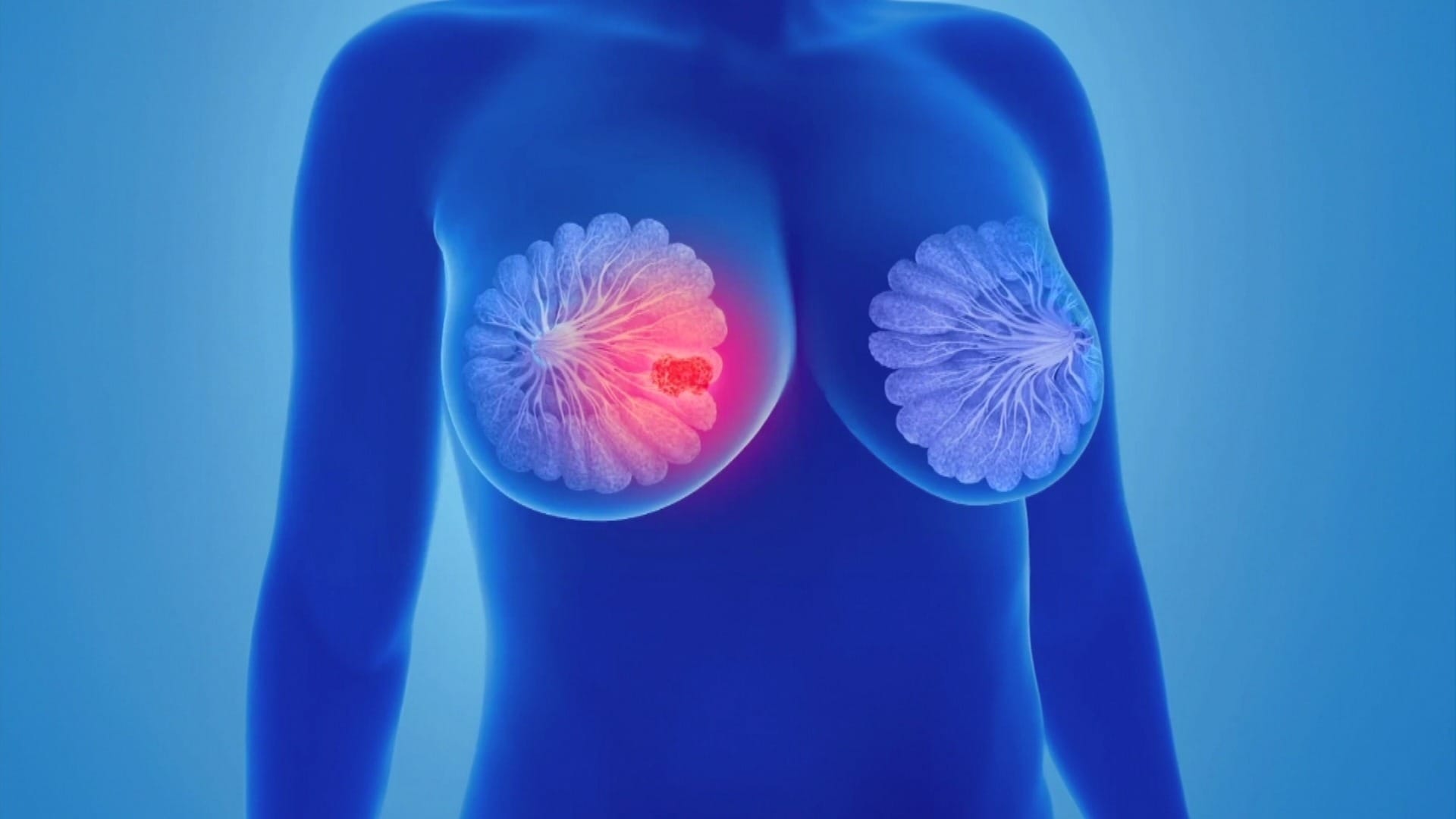 Estudo afirma que brócolis e couve-flor são armas contra o câncer de mama