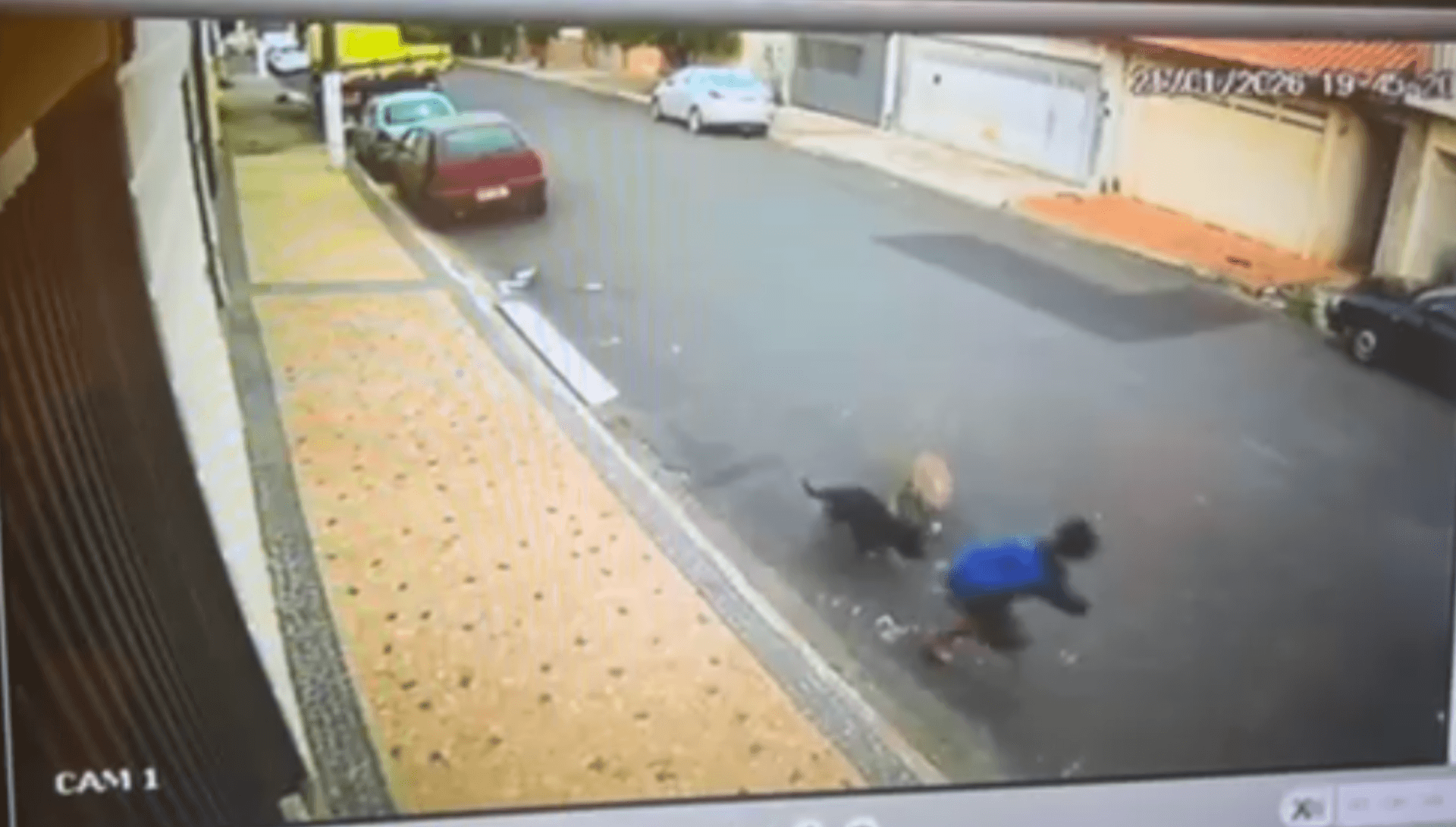Menino tem parte do couro cabeludo arrancado em ataque de pitbulls em SP