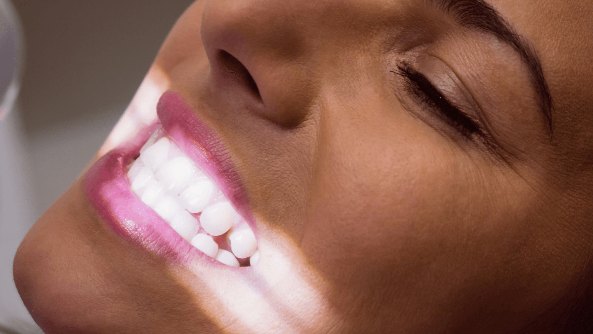 Clareamento dental caseiro pode trazer riscos à saúde bucal; Anvisa alerta