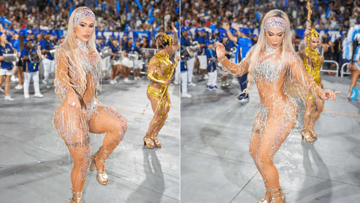 Outra musa retira costela para Carnaval: "Uma das plásticas mais difíceis"