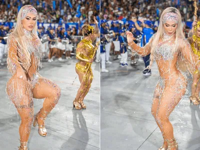 Outra musa retira costela para Carnaval: "Uma das plásticas mais difíceis"