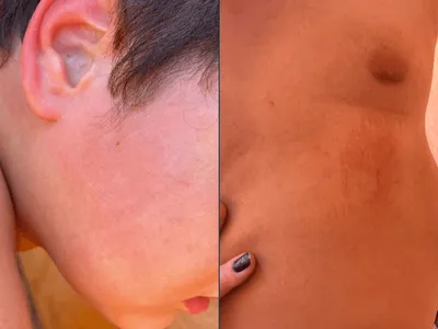 Pai é preso em Piracicaba após agredir o próprio filho com tapas no rosto