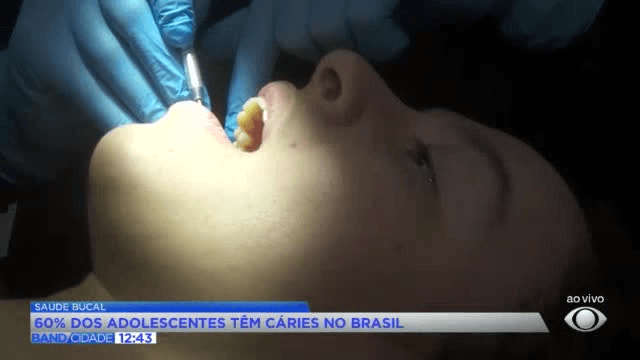 Quase 60% dos adolescentes têm cárie no Brasil, aponta estudo