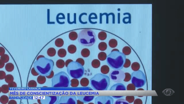 Fevereiro Laranja alerta para sinais e diagnóstico da leucemia