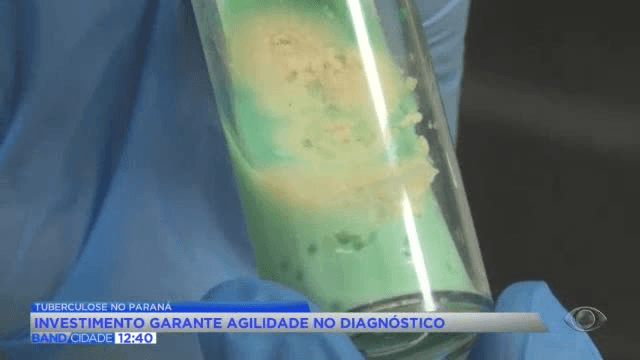 Paraná reduz diagnóstico da tuberculose para menos de 2 horas