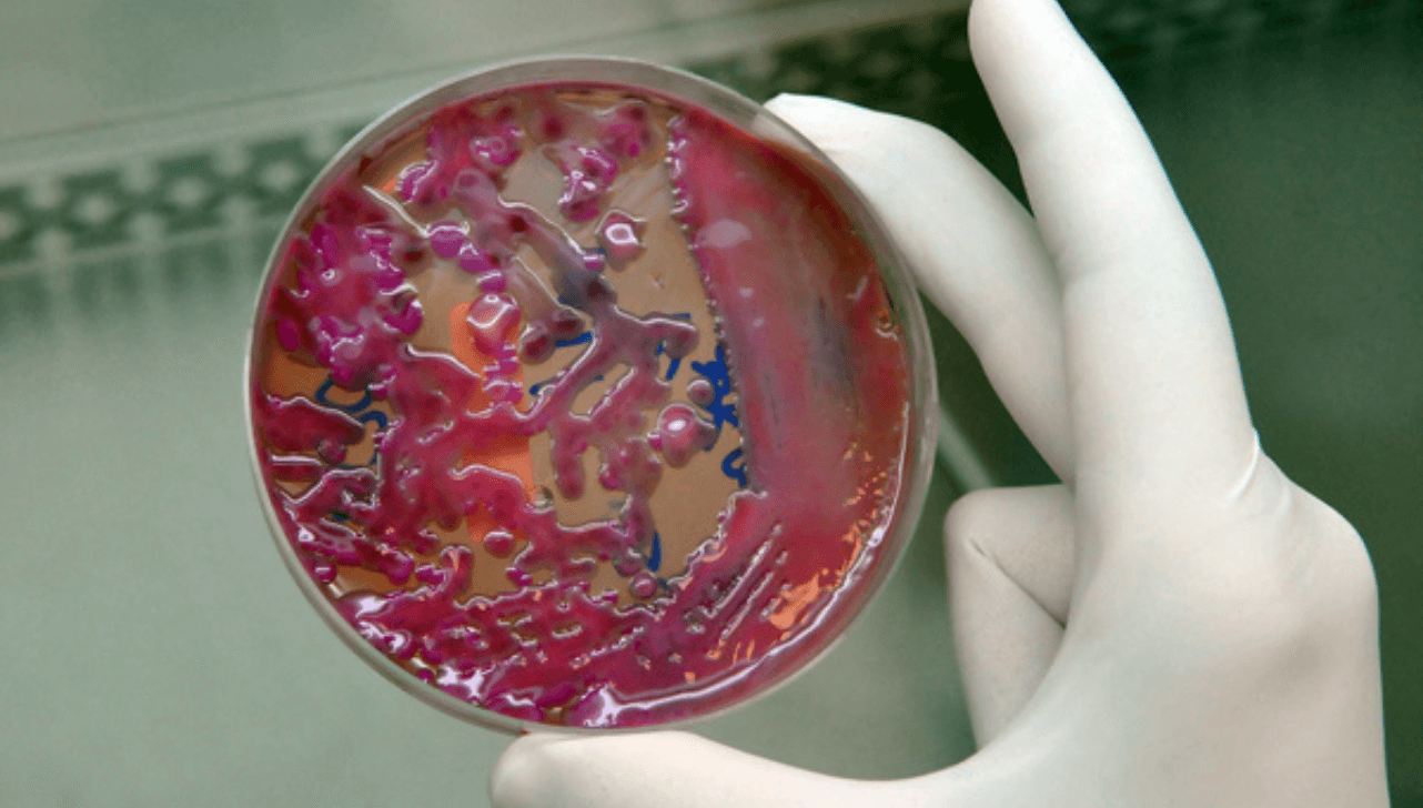 A bactéria KPC (Klebsiella pneumoniae Carbapenemase) é um microrganismo, modificado geneticamente no ambiente hospitalar e que é resistente aos antibióticos (Divulgação/SES-MG)