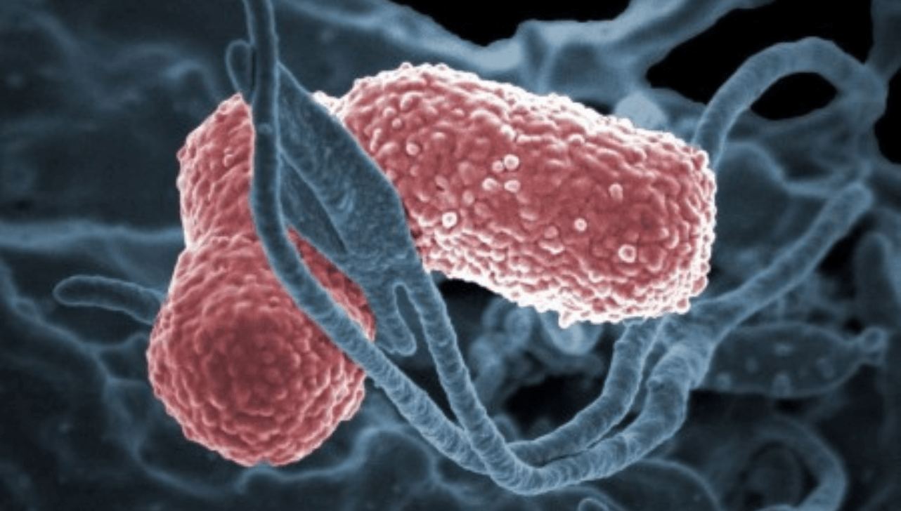 Superbactéria Klebsiella pneumoniae pode levar à pneumonia e à infecção de corrente sanguínea