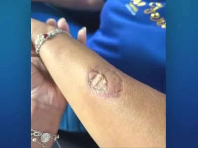 Mãe de aluno agride funcionárias e morde vice-diretora em escola no Paraná