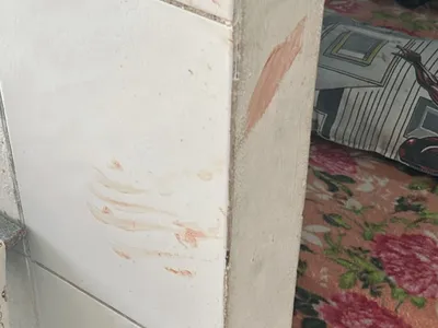 Mulher esfaqueada pelo companheiro descobre gravidez no hospital